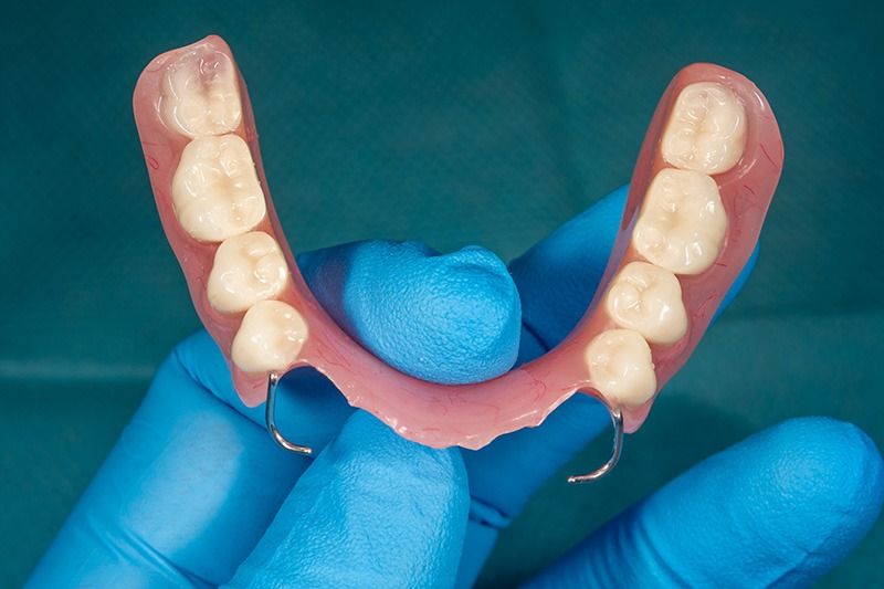 Restore Your Smile with Dentures and Partial Dentures in West Houston